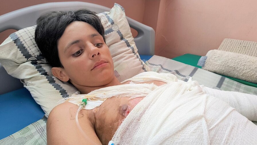 Одеський підліток отримав 45% опіків тіла, коли намагався зробити селфі на даху електрички: хлопця лікують у Львові